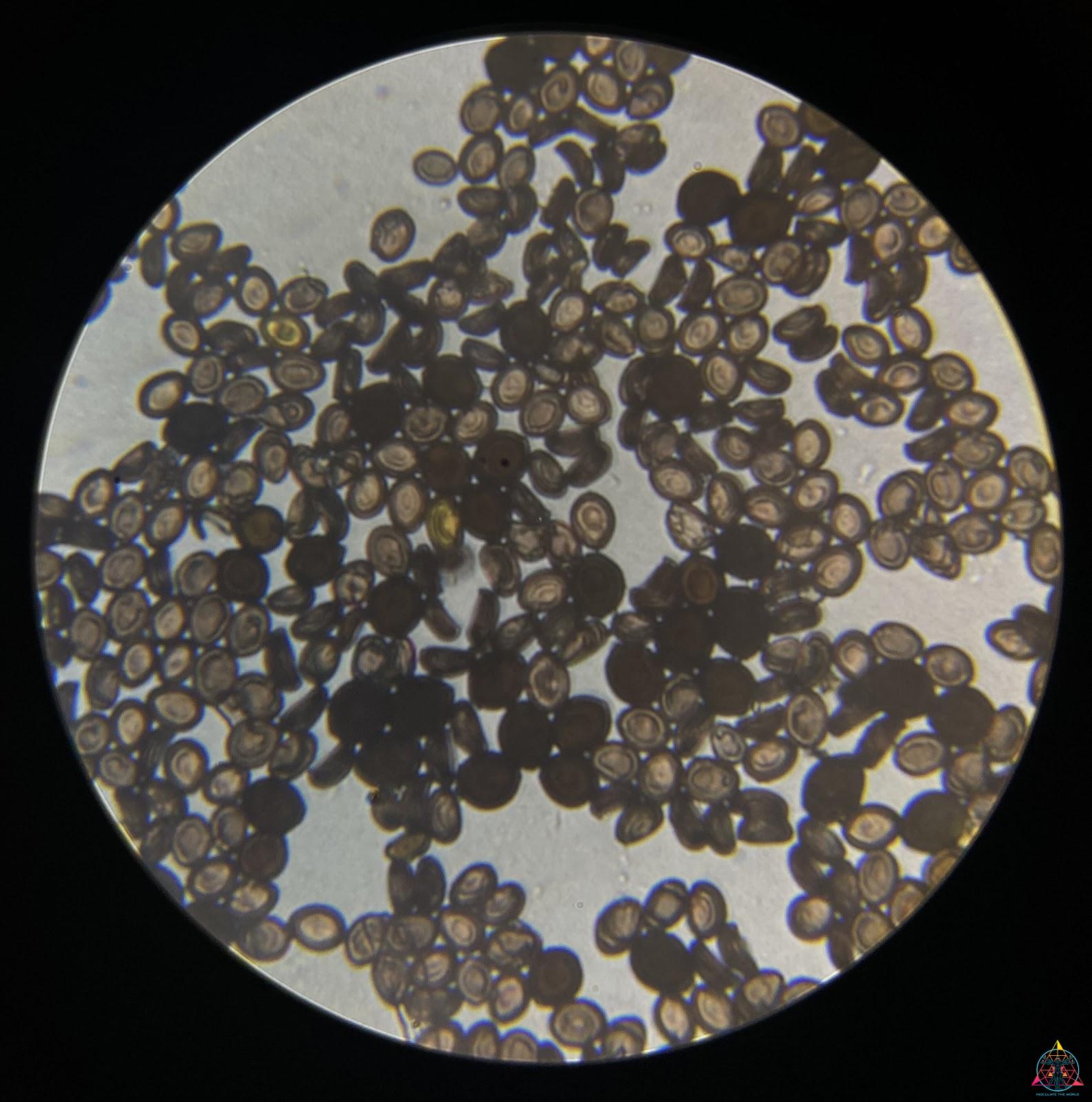 magic mushroom spores under a microscope